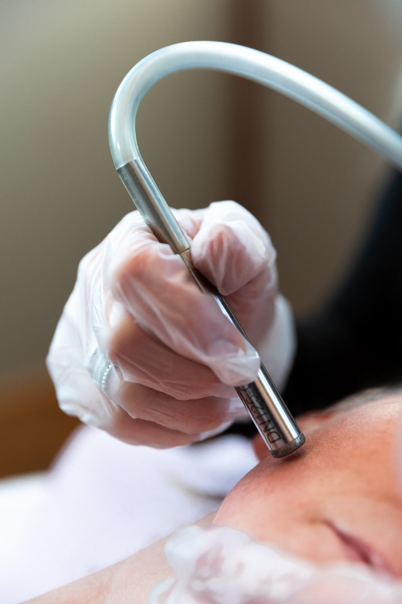 Microdermabrasion in Lebanon Restoration Wellness and Medspa