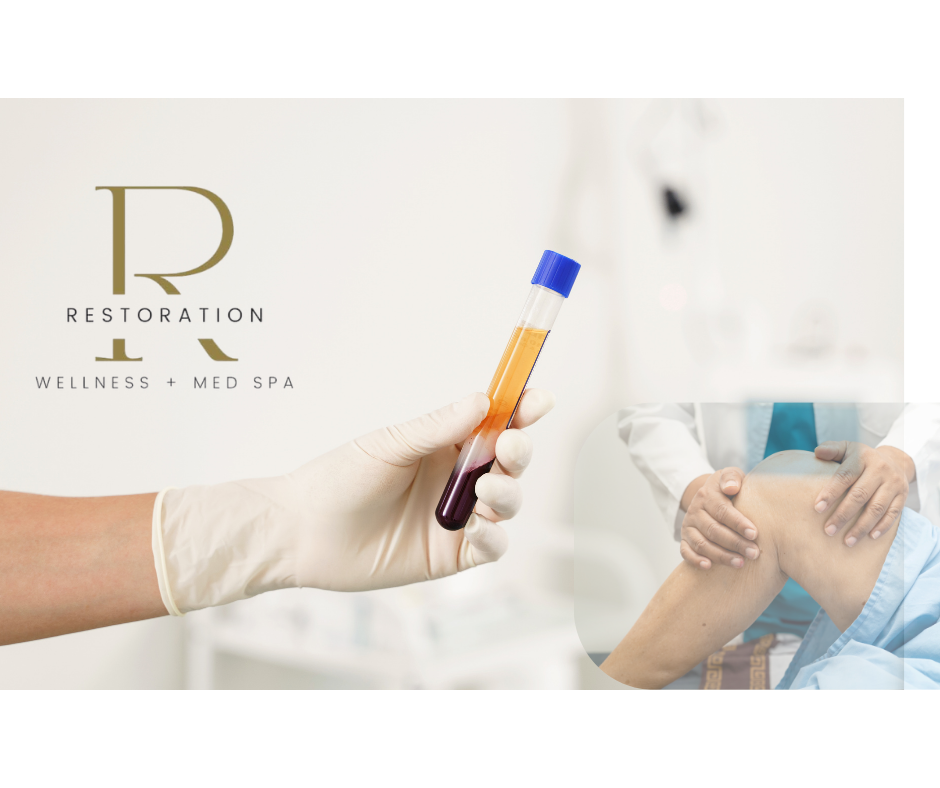 PDGF Therapy at Restoration Wellness in Lebanon, TN