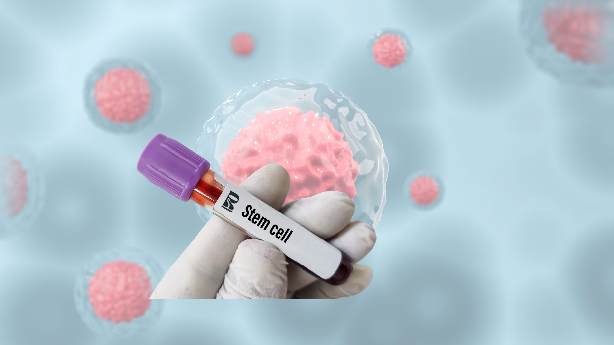 Stem Cell Therapy in Lebanon TN | Restoration Wellness